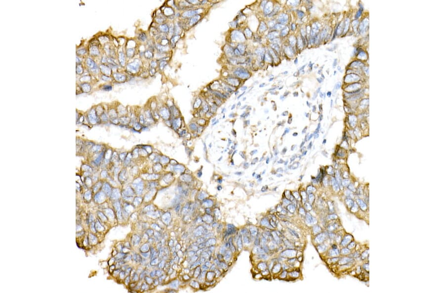 Immunohistochemistry - Anti-Cytokeratin 8 Antibody (A12853) - Antibodies.com