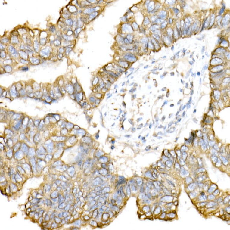 Immunohistochemistry - Anti-Cytokeratin 8 Antibody (A12853) - Antibodies.com