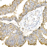 Immunohistochemistry - Anti-Cytokeratin 8 Antibody (A12853) - Antibodies.com