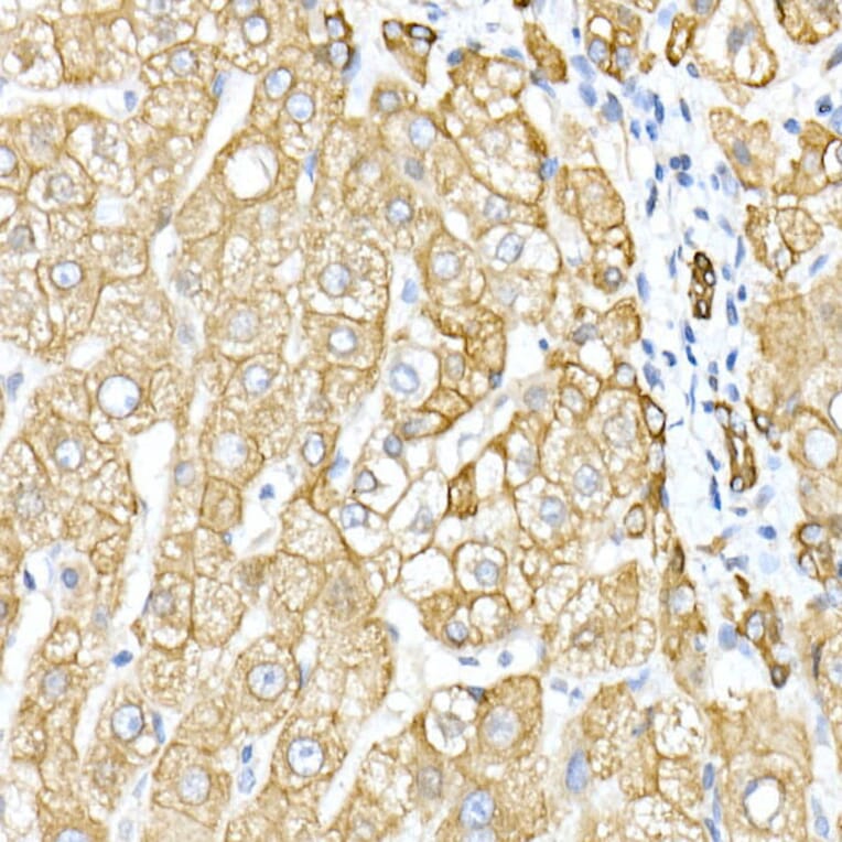 Immunohistochemistry - Anti-Cytokeratin 8 Antibody (A12853) - Antibodies.com