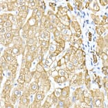 Immunohistochemistry - Anti-Cytokeratin 8 Antibody (A12853) - Antibodies.com