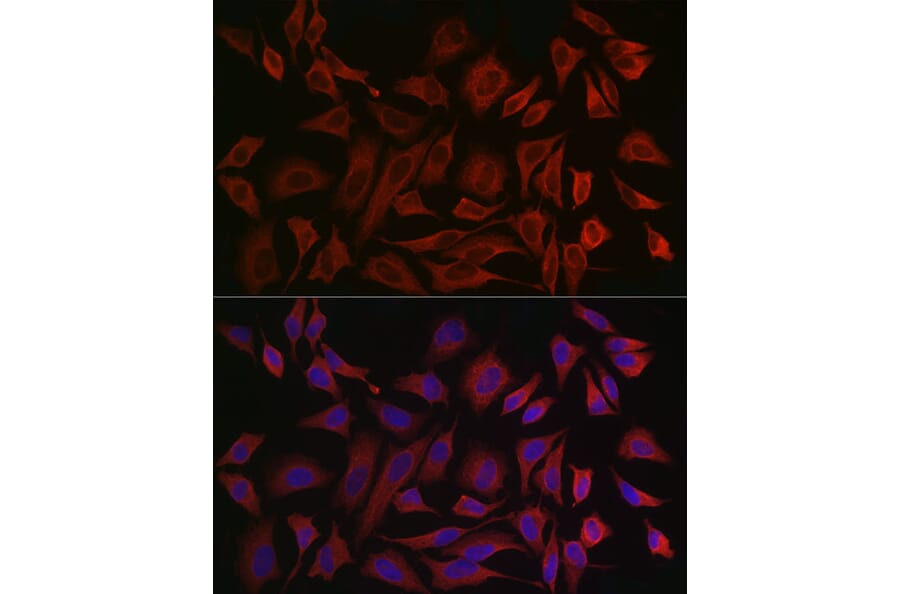 Immunofluorescence - Anti-Cytokeratin 8 Antibody (A12853) - Antibodies.com