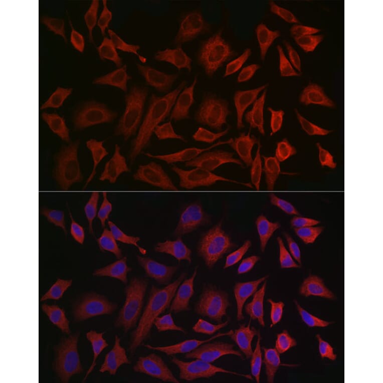 Immunofluorescence - Anti-Cytokeratin 8 Antibody (A12853) - Antibodies.com