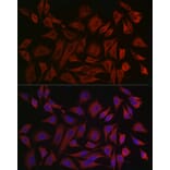 Immunofluorescence - Anti-Cytokeratin 8 Antibody (A12853) - Antibodies.com