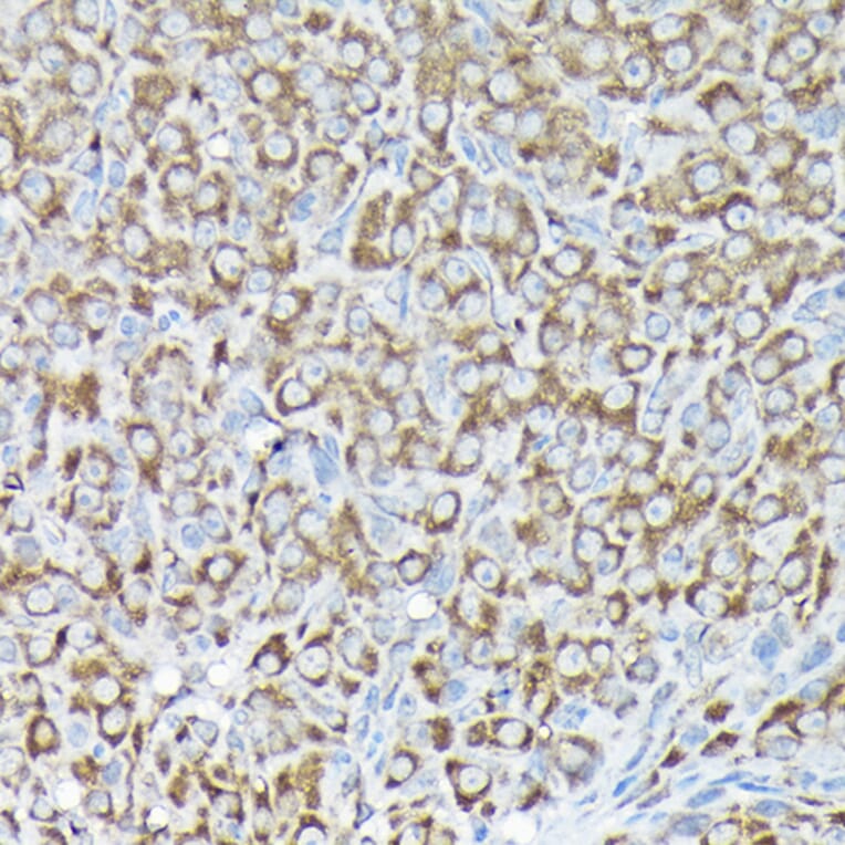 Immunohistochemistry - Anti-RPS15A Antibody (A12854) - Antibodies.com