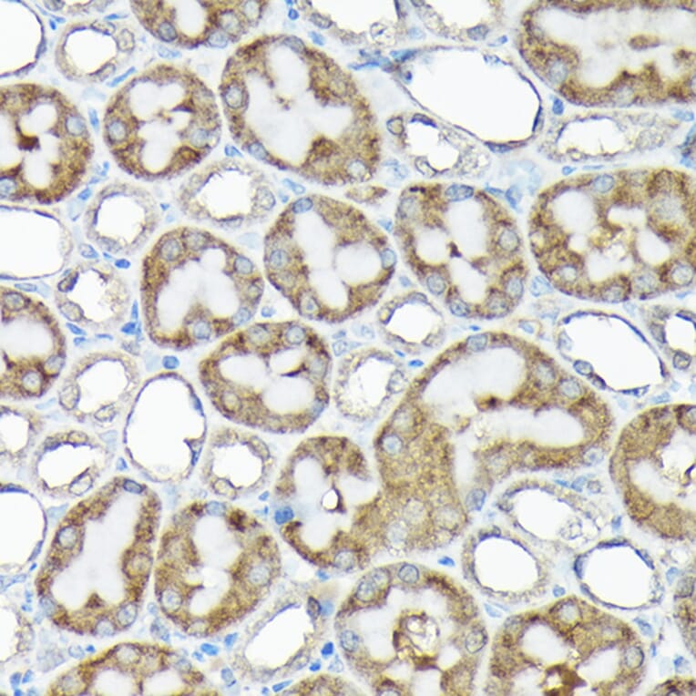 Immunohistochemistry - Anti-RPS15A Antibody (A12854) - Antibodies.com