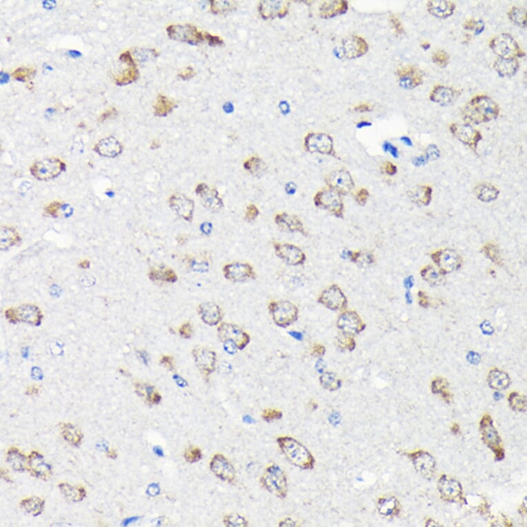 Immunohistochemistry - Anti-RPS15A Antibody (A12854) - Antibodies.com
