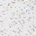 Immunohistochemistry - Anti-RPS15A Antibody (A12854) - Antibodies.com