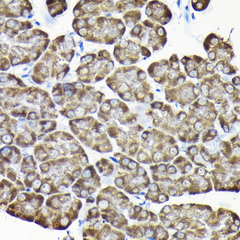 Immunohistochemistry - Anti-RPS15A Antibody (A12854) - Antibodies.com