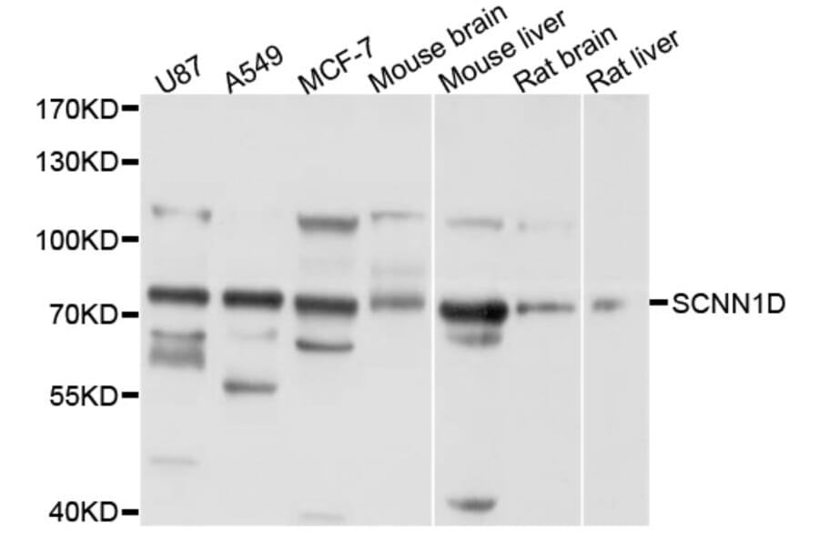 Western Blot - Anti-SCNN1D Antibody (A10242) - Antibodies.com