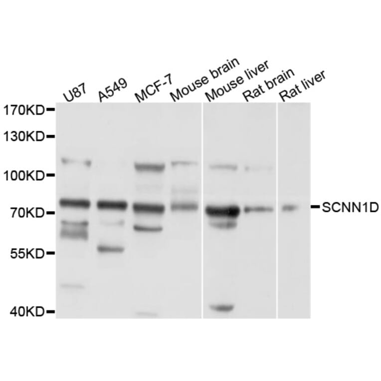 Western Blot - Anti-SCNN1D Antibody (A10242) - Antibodies.com