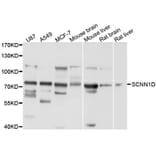 Western Blot - Anti-SCNN1D Antibody (A10242) - Antibodies.com