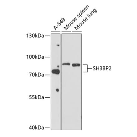 Western Blot - Anti-SH3BP2 Antibody (A12856) - Antibodies.com