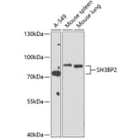 Western Blot - Anti-SH3BP2 Antibody (A12856) - Antibodies.com