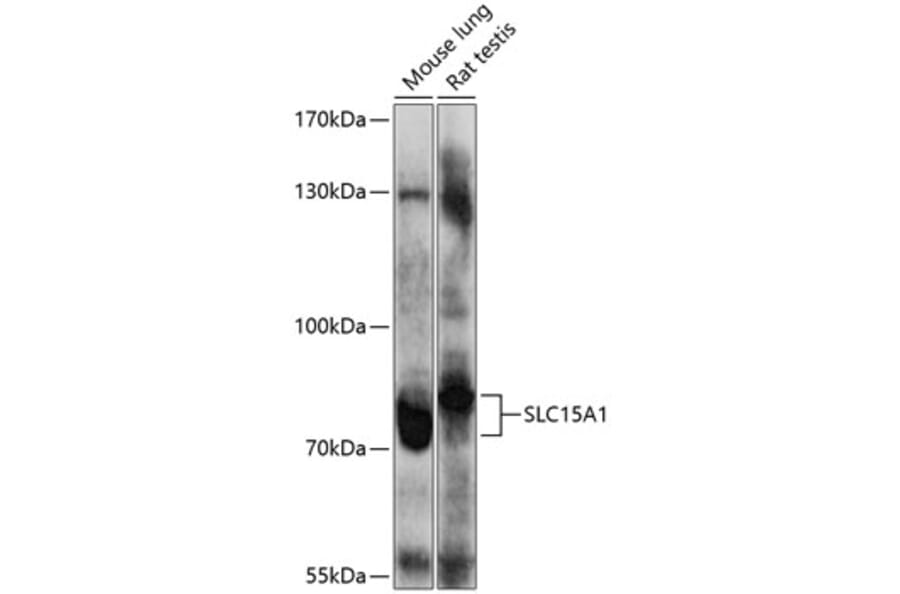 Western Blot - Anti-SLC15A1/PEPT1 Antibody (A12857) - Antibodies.com