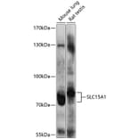 Western Blot - Anti-SLC15A1/PEPT1 Antibody (A12857) - Antibodies.com