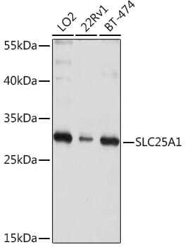 Western blot analysis of extracts of various cell lines, using Anti-SLC25A1 Antibody (A10247) at 1:1,000 dilution. Secondary antibody: Goat Anti-Rabbit IgG (H+L) (HRP) (AS014) at 1:10,000 dilution. Lysates / proteins: 25µg per lane. Blocking buffer: 3% non-fat dry milk in TBST. Detection: ECL Enhanced Kit (RM00021). Exposure time: 30s.
