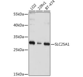 Western Blot - Anti-Slc25a1 Antibody (A12858) - Antibodies.com
