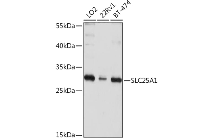 Western Blot - Anti-Slc25a1 Antibody (A12858) - Antibodies.com