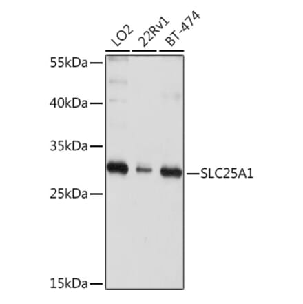 Western Blot - Anti-Slc25a1 Antibody (A12858) - Antibodies.com