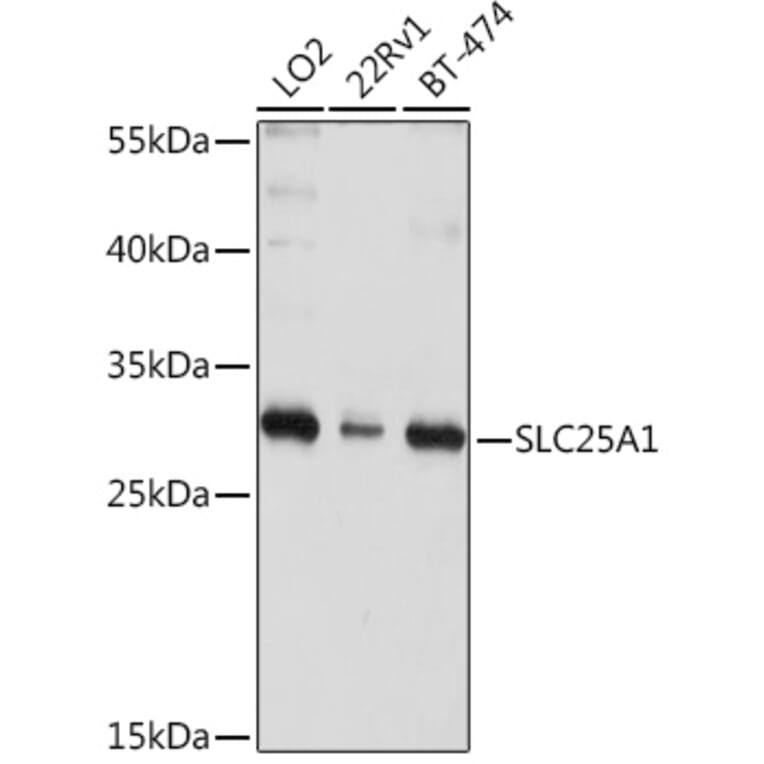 Western Blot - Anti-Slc25a1 Antibody (A12858) - Antibodies.com