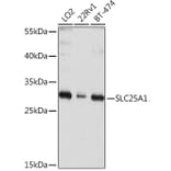 Western Blot - Anti-Slc25a1 Antibody (A12858) - Antibodies.com