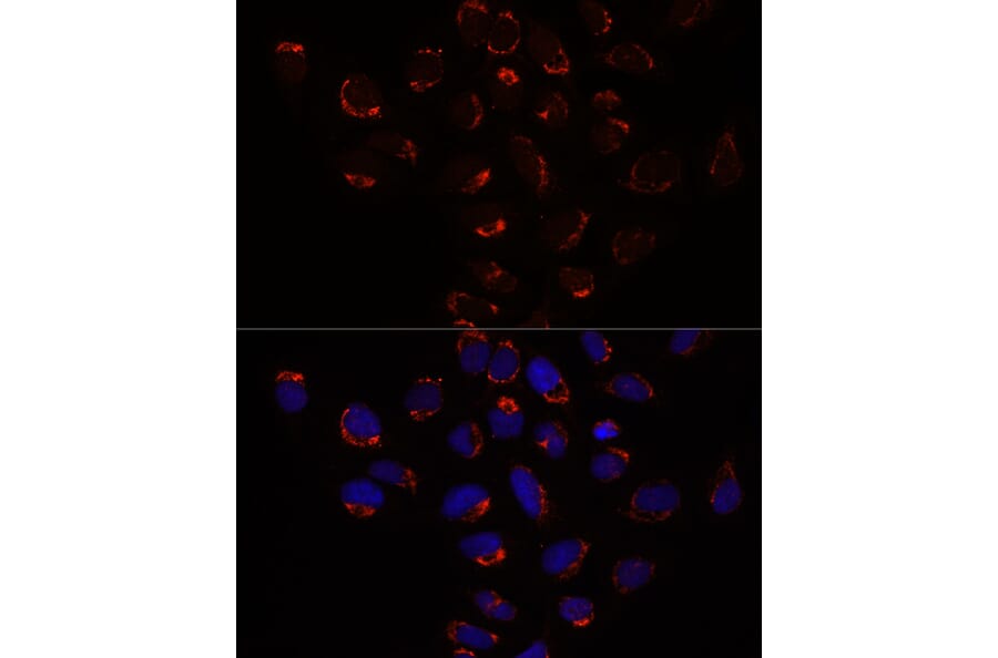 Immunofluorescence - Anti-Slc25a1 Antibody (A12858) - Antibodies.com