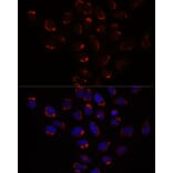 Immunofluorescence - Anti-Slc25a1 Antibody (A12858) - Antibodies.com