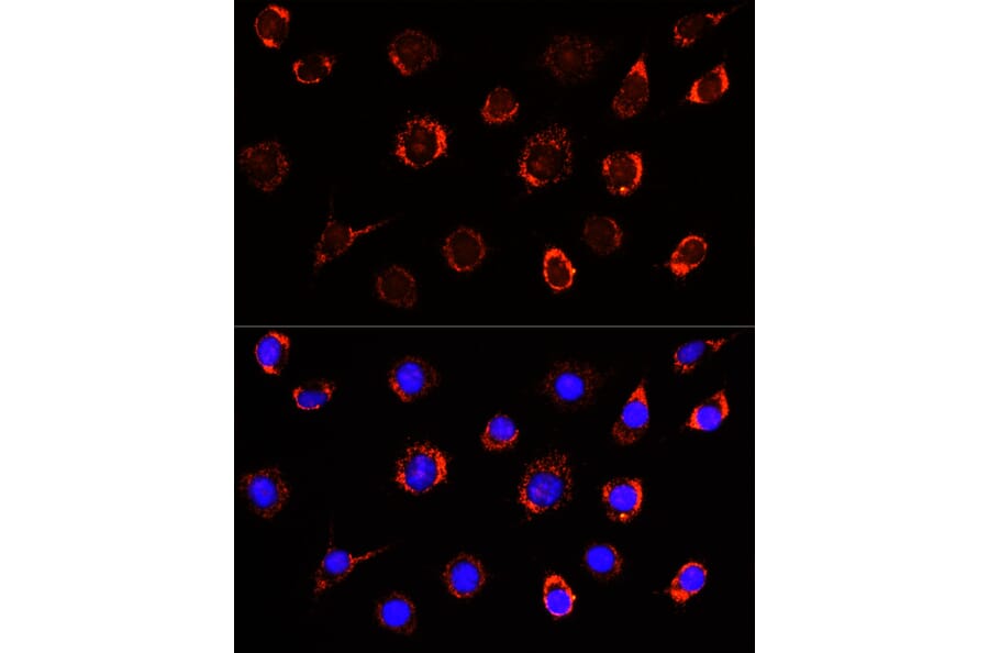 Immunofluorescence - Anti-Slc25a1 Antibody (A12858) - Antibodies.com