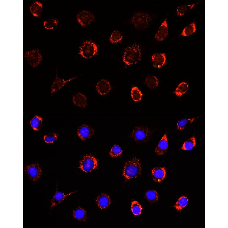 Immunofluorescence - Anti-Slc25a1 Antibody (A12858) - Antibodies.com