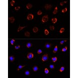 Immunofluorescence - Anti-Slc25a1 Antibody (A12858) - Antibodies.com