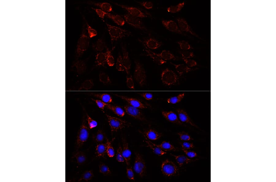 Immunofluorescence - Anti-Slc25a1 Antibody (A12858) - Antibodies.com