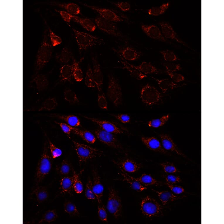 Immunofluorescence - Anti-Slc25a1 Antibody (A12858) - Antibodies.com