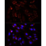 Immunofluorescence - Anti-Slc25a1 Antibody (A12858) - Antibodies.com