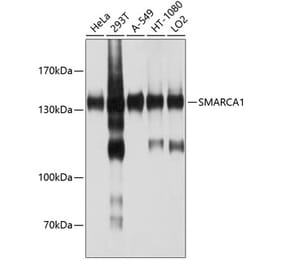 Western Blot - Anti-SNF2L Antibody (A12859) - Antibodies.com