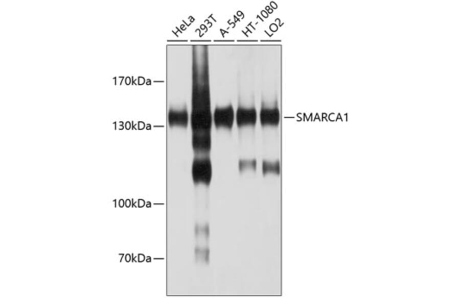 Western Blot - Anti-SNF2L Antibody (A12859) - Antibodies.com