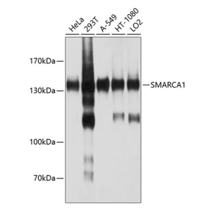 Western Blot - Anti-SNF2L Antibody (A12859) - Antibodies.com