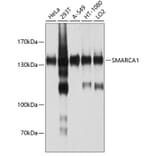 Western Blot - Anti-SNF2L Antibody (A12859) - Antibodies.com