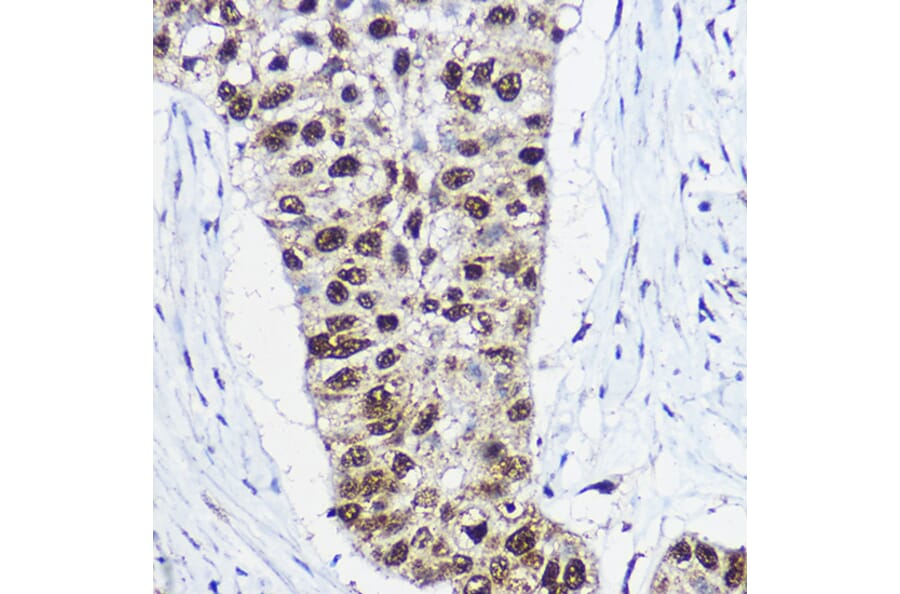 Immunohistochemistry - Anti-SNF2L Antibody (A12859) - Antibodies.com