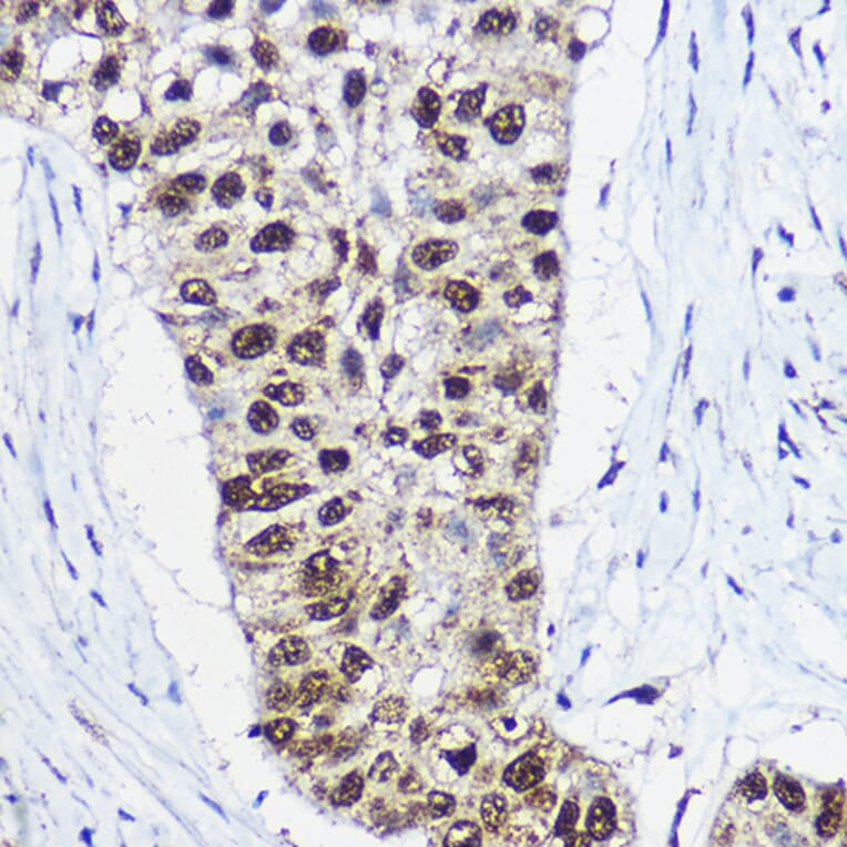 Immunohistochemistry - Anti-SNF2L Antibody (A12859) - Antibodies.com