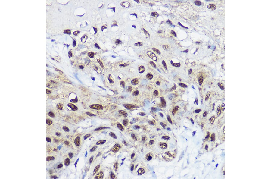 Immunohistochemistry - Anti-SNF2L Antibody (A12859) - Antibodies.com