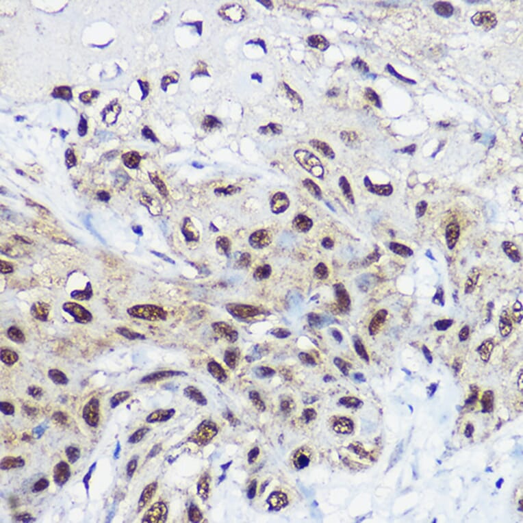 Immunohistochemistry - Anti-SNF2L Antibody (A12859) - Antibodies.com