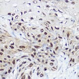 Immunohistochemistry - Anti-SNF2L Antibody (A12859) - Antibodies.com