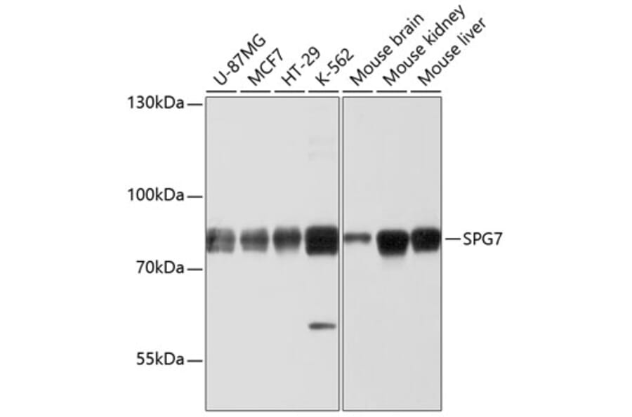 Western Blot - Anti-SPG7/PGN Antibody (A12860) - Antibodies.com
