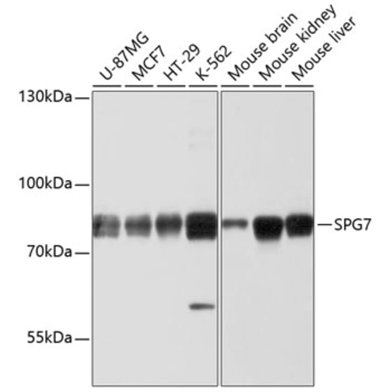 Western Blot - Anti-SPG7/PGN Antibody (A12860) - Antibodies.com