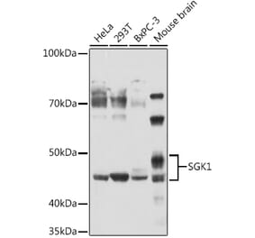Western Blot - Anti-SGK1 Antibody (A12861) - Antibodies.com