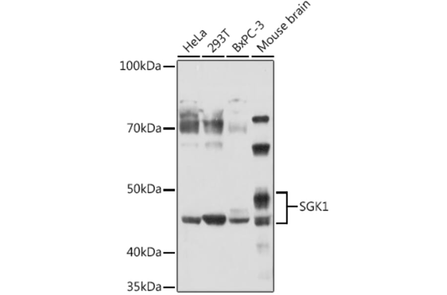 Western Blot - Anti-SGK1 Antibody (A12861) - Antibodies.com
