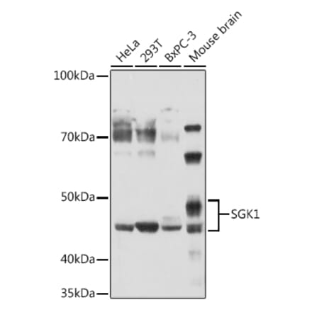 Western Blot - Anti-SGK1 Antibody (A12861) - Antibodies.com