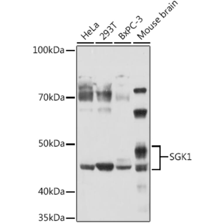Western Blot - Anti-SGK1 Antibody (A12861) - Antibodies.com