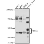 Western Blot - Anti-SGK1 Antibody (A12861) - Antibodies.com